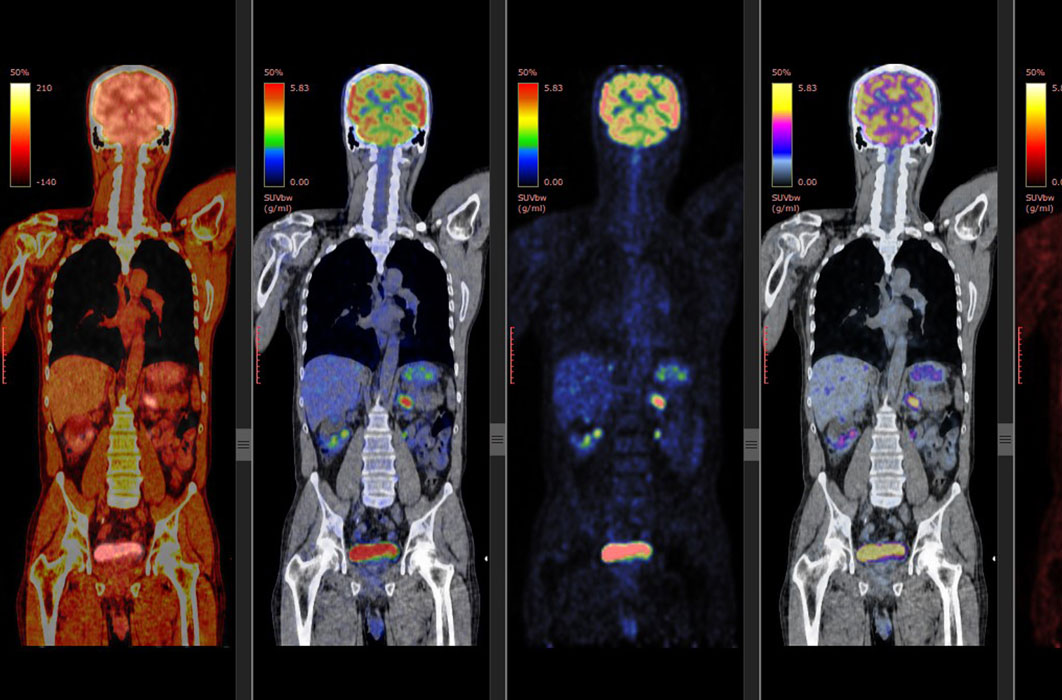 Premier Radiology Tennessee PET/CT