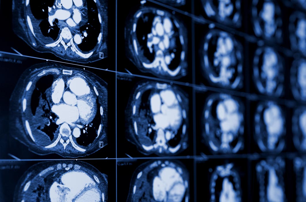 Premier_WI_studies_ct Computed tomography CT images